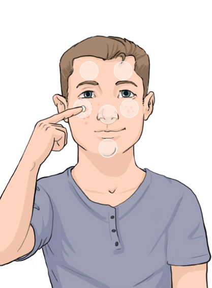 Boy rubbing ONEXTON Gel on face