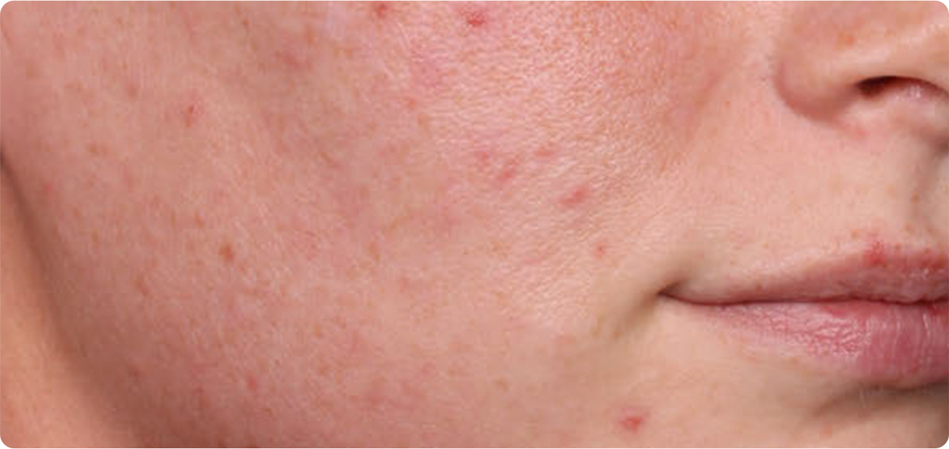 Baseline and After Results