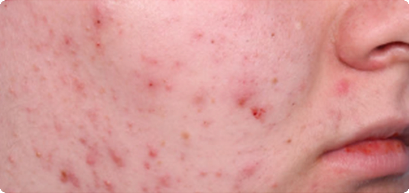 Baseline and After Results