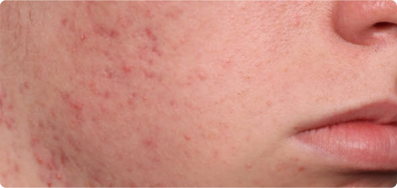 Baseline and After Results