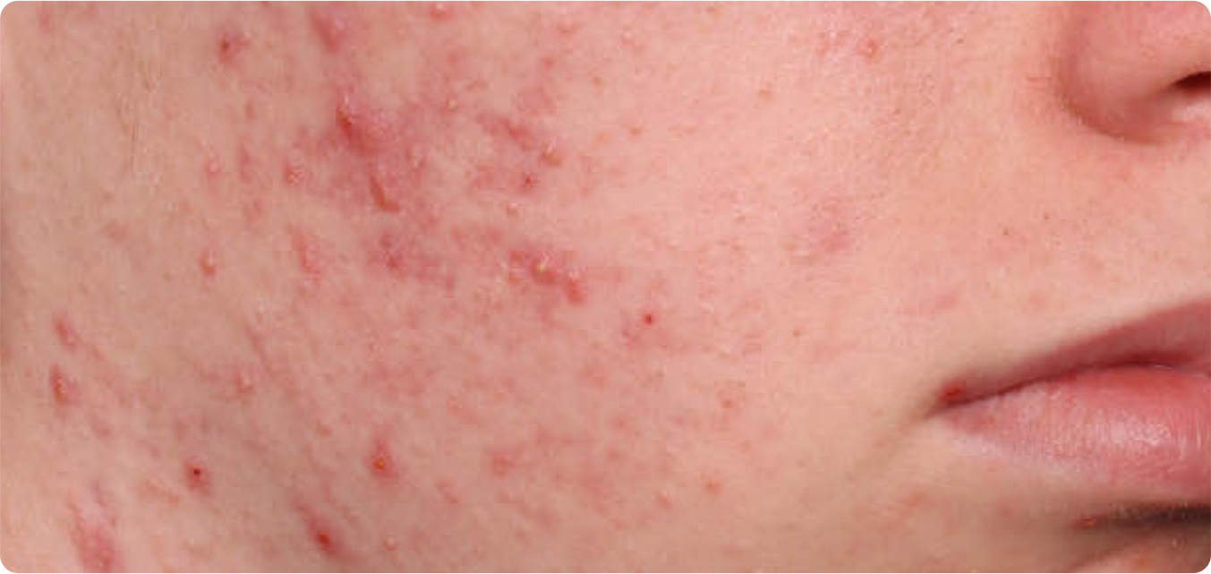 Baseline and After Results